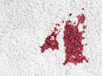 How To Remove Dried Blood Stains